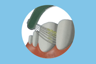 Technológia Buletedan